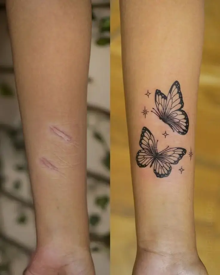 Tattoo Removal & Cover-up example — Trendy Tattoo & Piercing Studio, Vijayawada